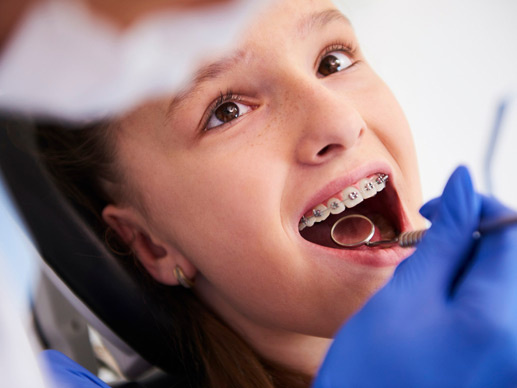 Orthodontic Treatment