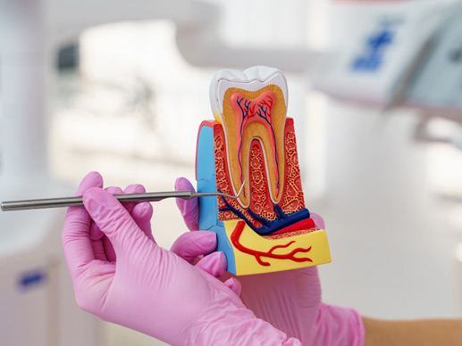 Root Canal Treatments